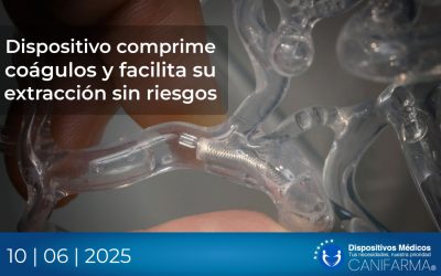 Dispositivo comprime coágulos y facilita su extracción sin riesgos