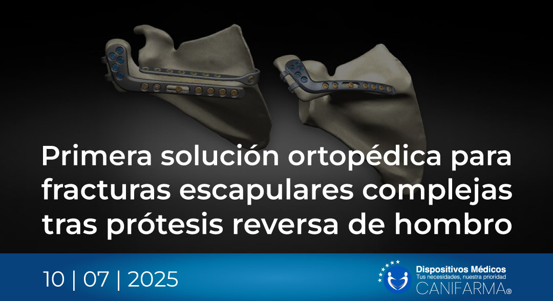 EquinoxeScapulaReconstructionSystem