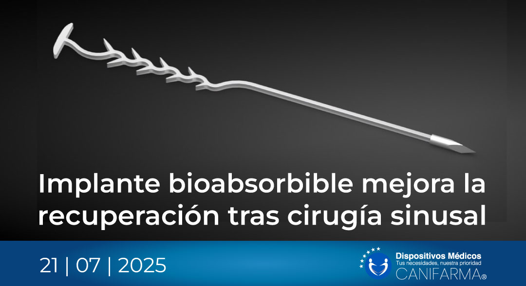 Implante bioabsorbible mejora la recuperación tras cirugía sinusal