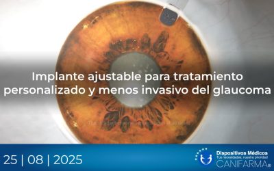 Implante ajustable para tratamiento personalizado y menos invasivo del glaucoma