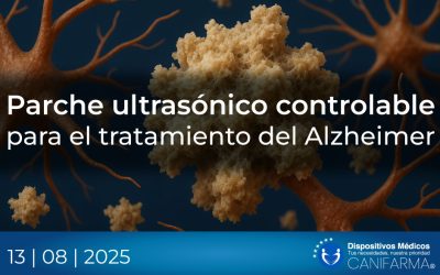 Parche ultrasónico controlable para el tratamiento del Alzheimer