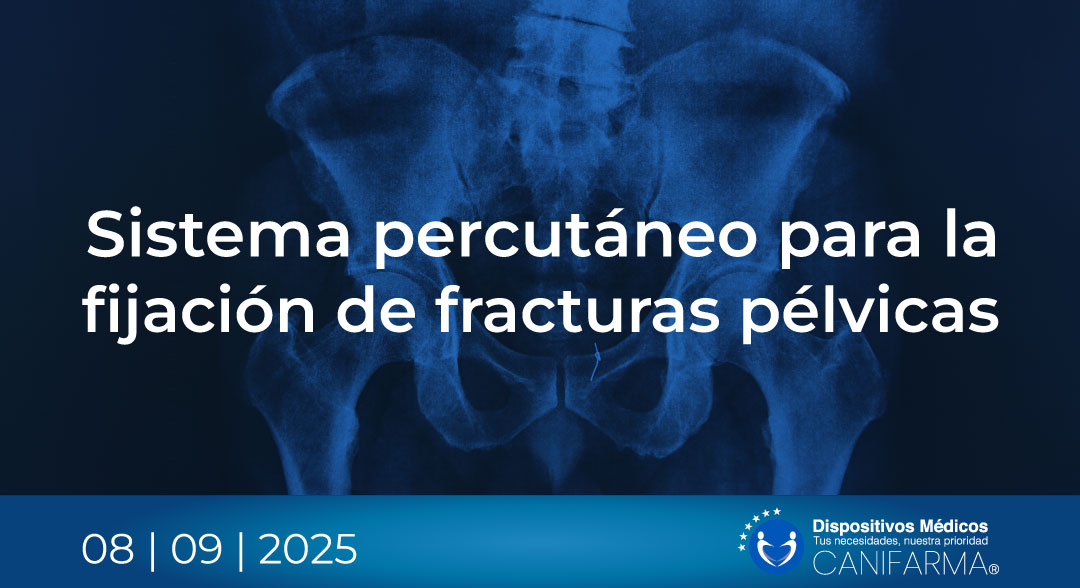 Sistema percutáneo para la fijación de fracturas pélvicas