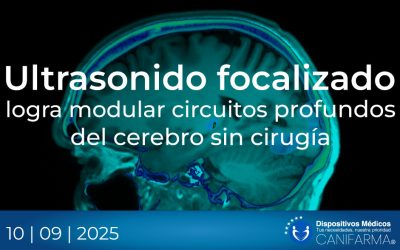 Ultrasonido focalizado logra modular circuitos profundos del cerebro sin cirugía