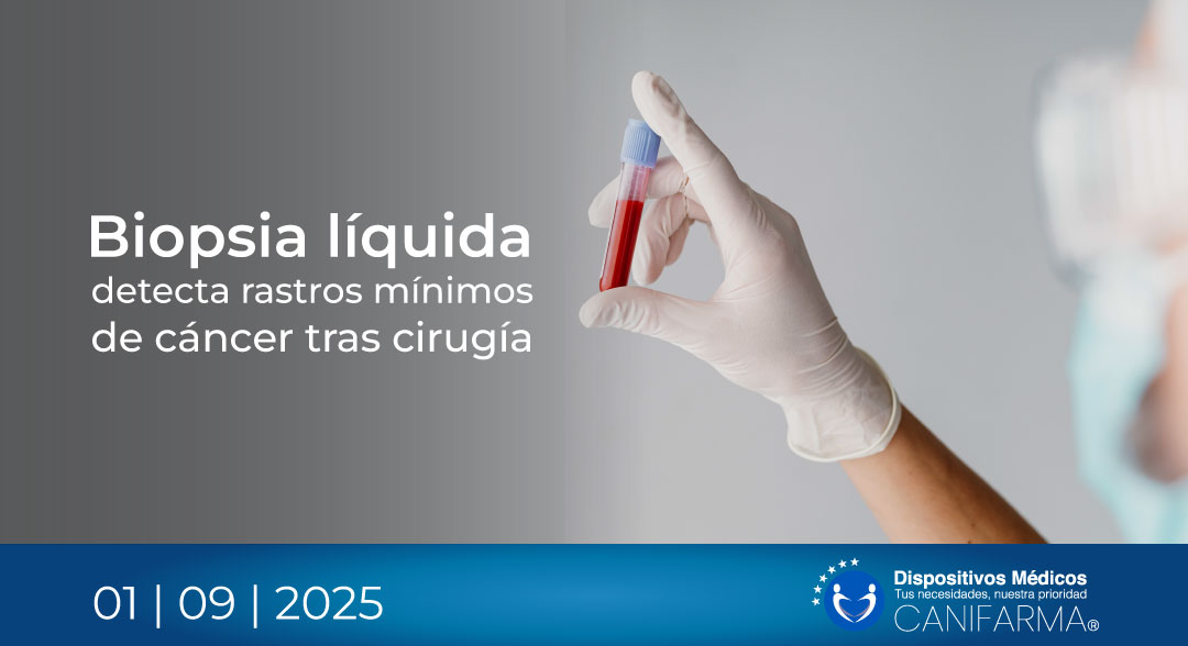Biopsia líquida detecta rastros mínimos de cáncer tras cirugía