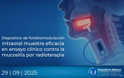 Dispositivo de fotobiomodulación intraoral muestra eficacia en ensayo clínico contra la mucositis por radioterapia