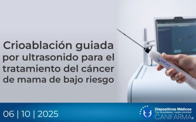 Crioablación guiada por ultrasonido para el tratamiento del cáncer de mama de bajo riesgo