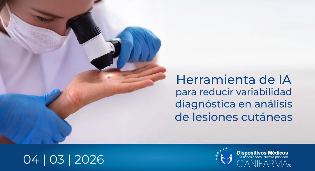 Herramienta de IA para reducir variabilidad diagnóstica en análisis de lesiones cutáneas