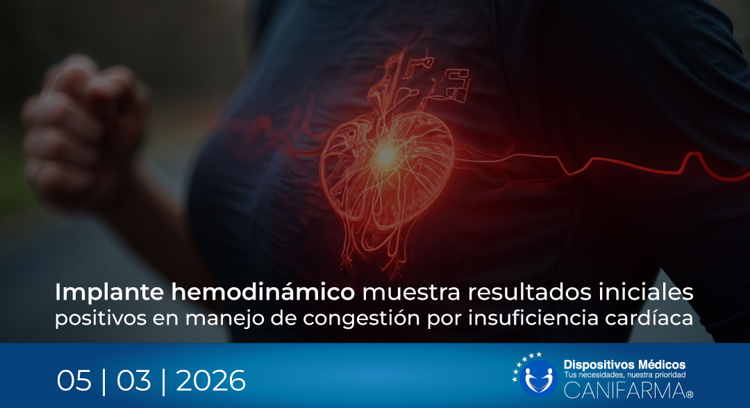 Implante hemodinámico muestra resultados iniciales positivos en manejo de congestión por insuficiencia cardíaca