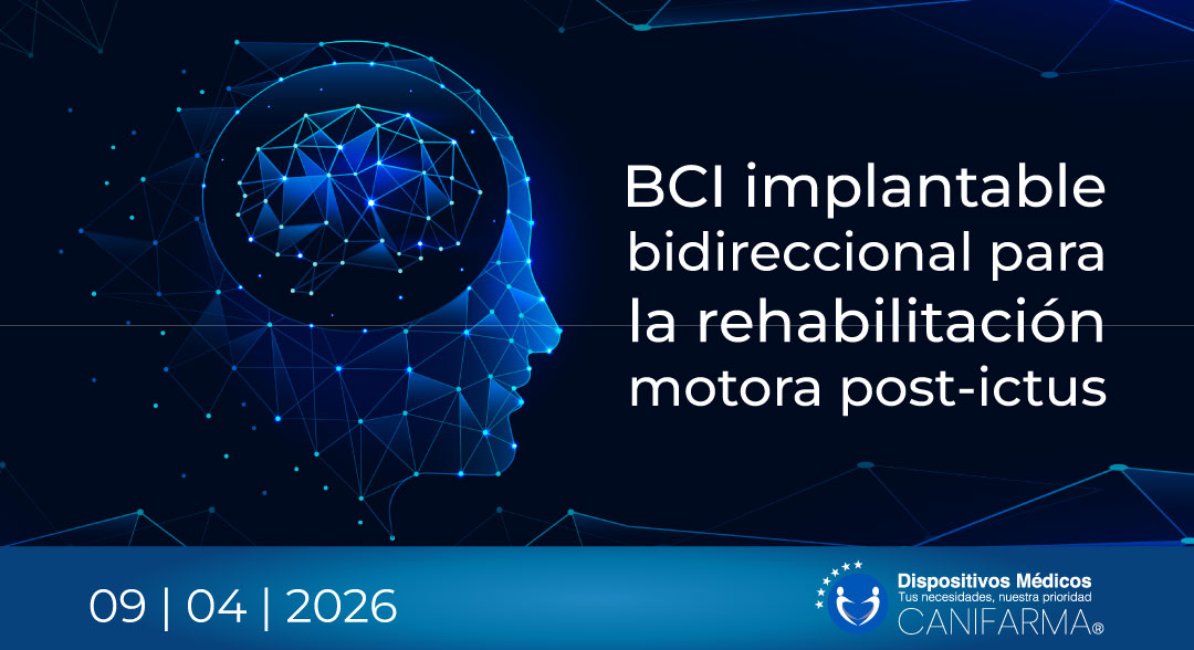 BCI implantable bidireccional para la rehabilitación motora post-ictus