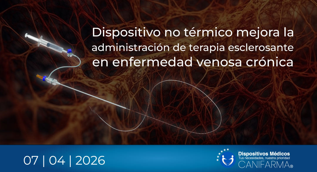Dispositivo no térmico mejora la administración de terapia esclerosante en enfermedad venosa crónica