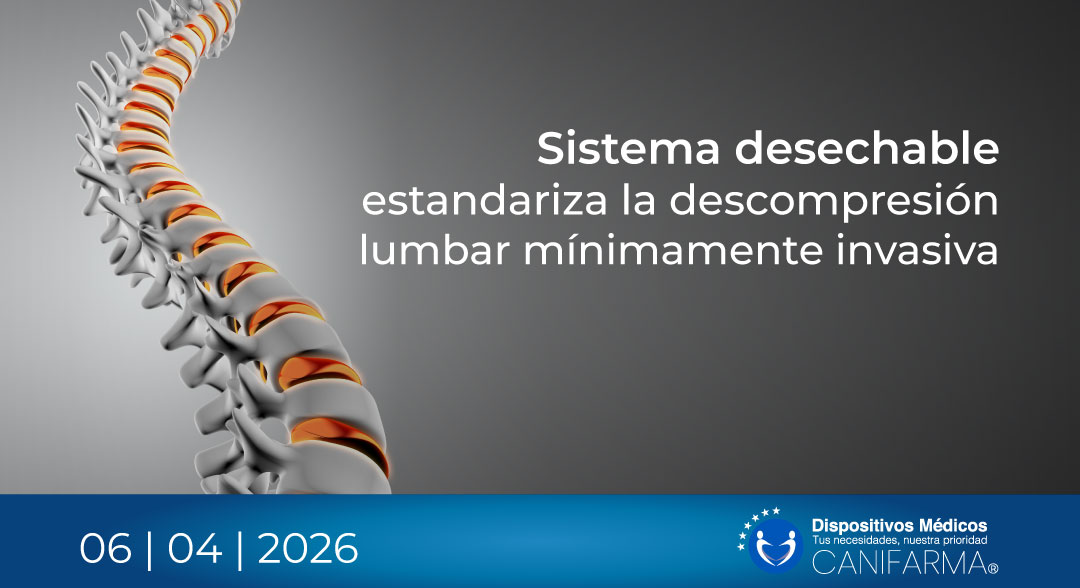 Vantage-AllevionMedical