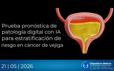 Prueba pronóstica de patología digital con IA para estratificación de riesgo en cáncer de vejiga