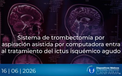 Sistema de trombectomía por aspiración asistida por computadora entra al tratamiento del ictus isquémico agudo