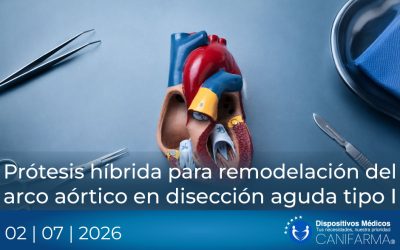 Prótesis híbrida para remodelación del arco aórtico en disección aguda tipo I