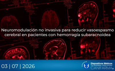 Neuromodulación no invasiva para reducir vasoespasmo cerebral en pacientes con hemorragia subaracnoidea
