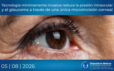 Tecnología mínimamente invasiva reduce la presión intraocular y el glaucoma  a través de una única microincisión corneal